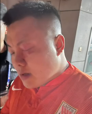 山东球迷被砸伤